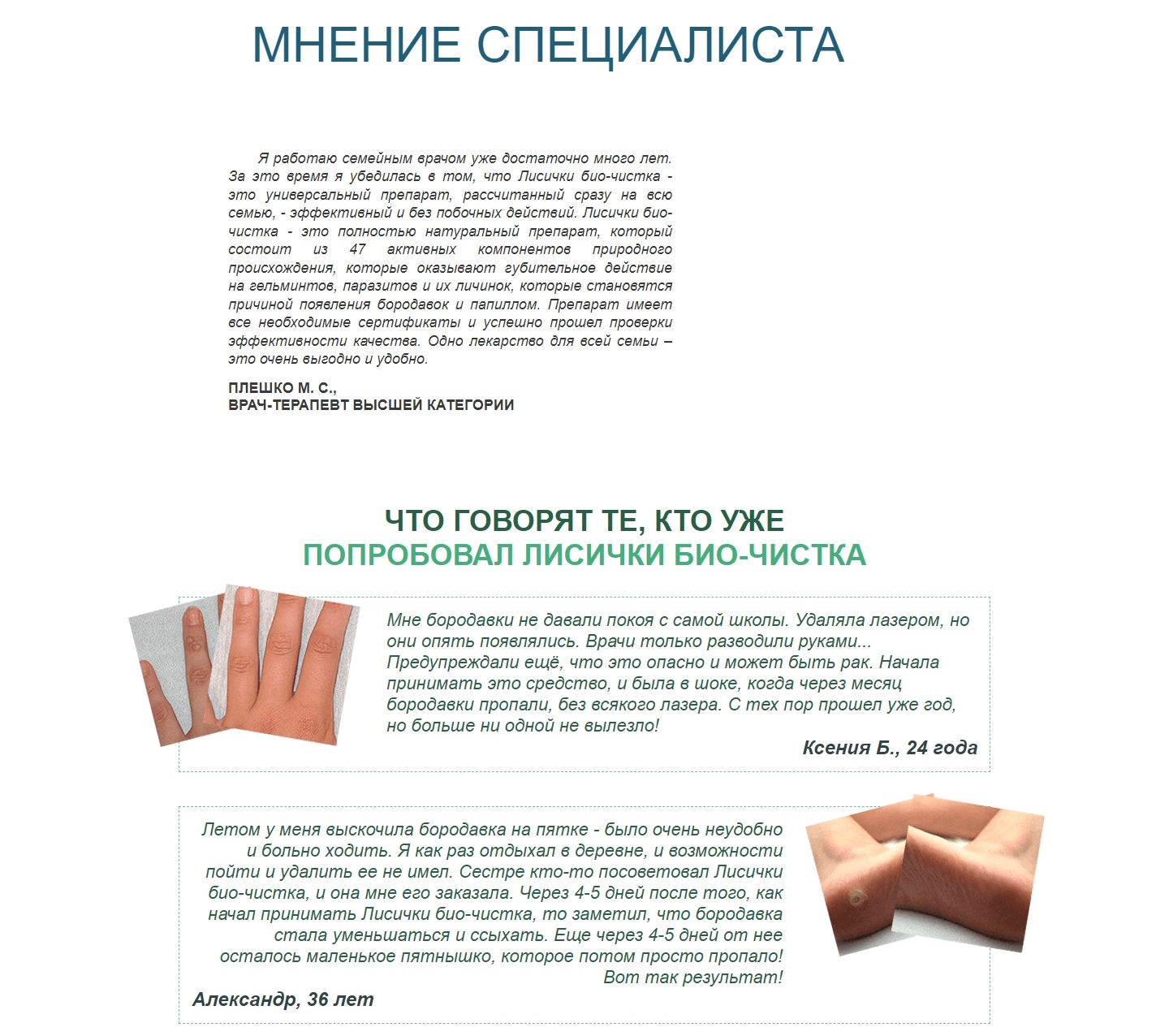Продажа Лендинга Средство От Папиллом и Бородавок