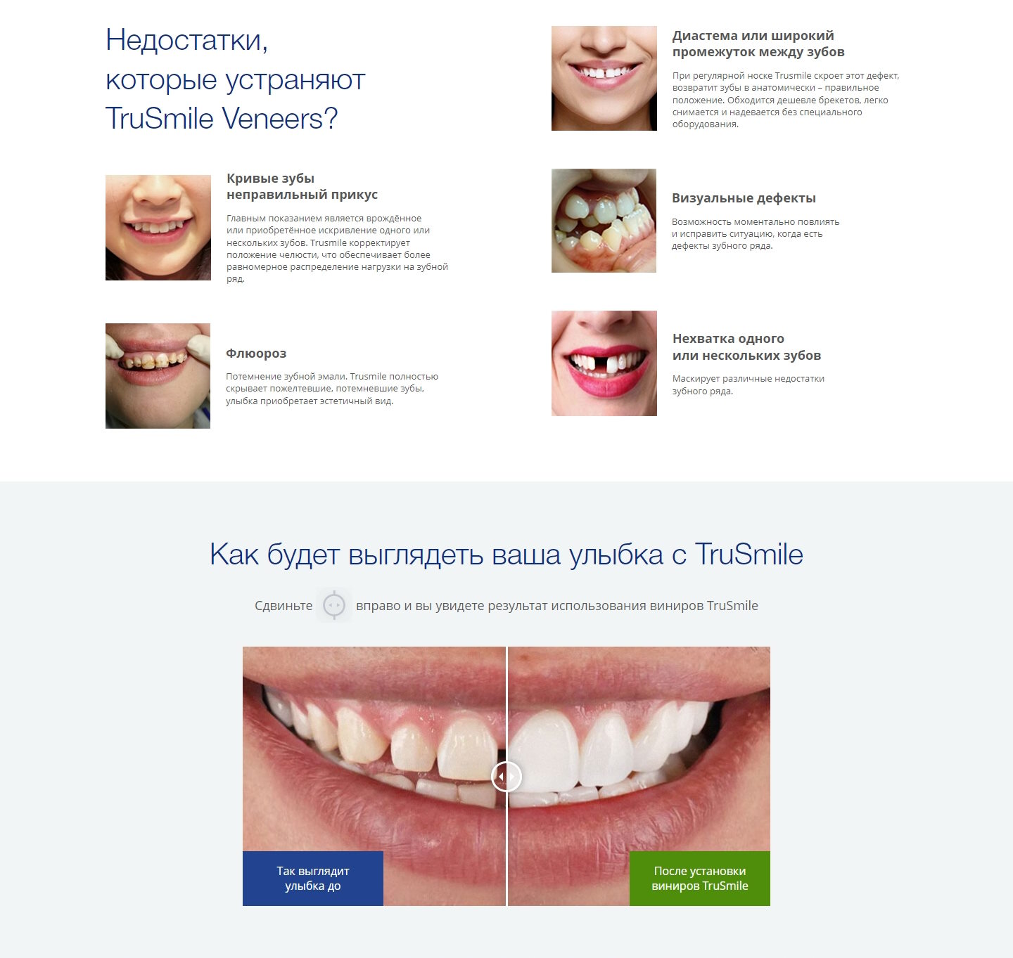 Стоимость Сайта Лендинга Съемные Виниры TruSmile Veneers