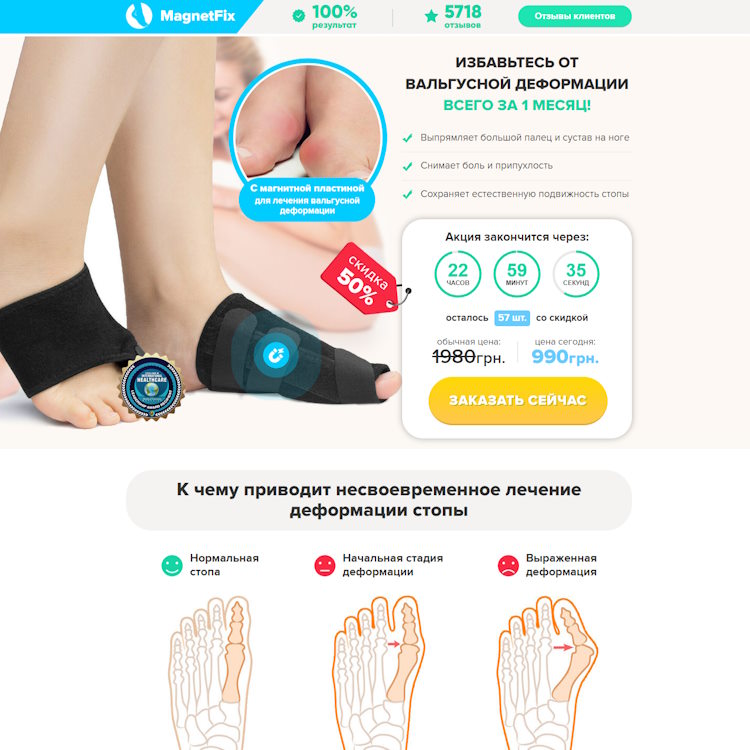 Купить Готовый Лендинг Магнитная Вальгусная Шина MagnetFix