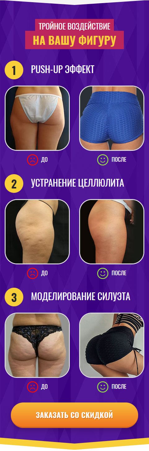 Стоимость Сайта Лендинга Антицеллюлитные Шорты Flex