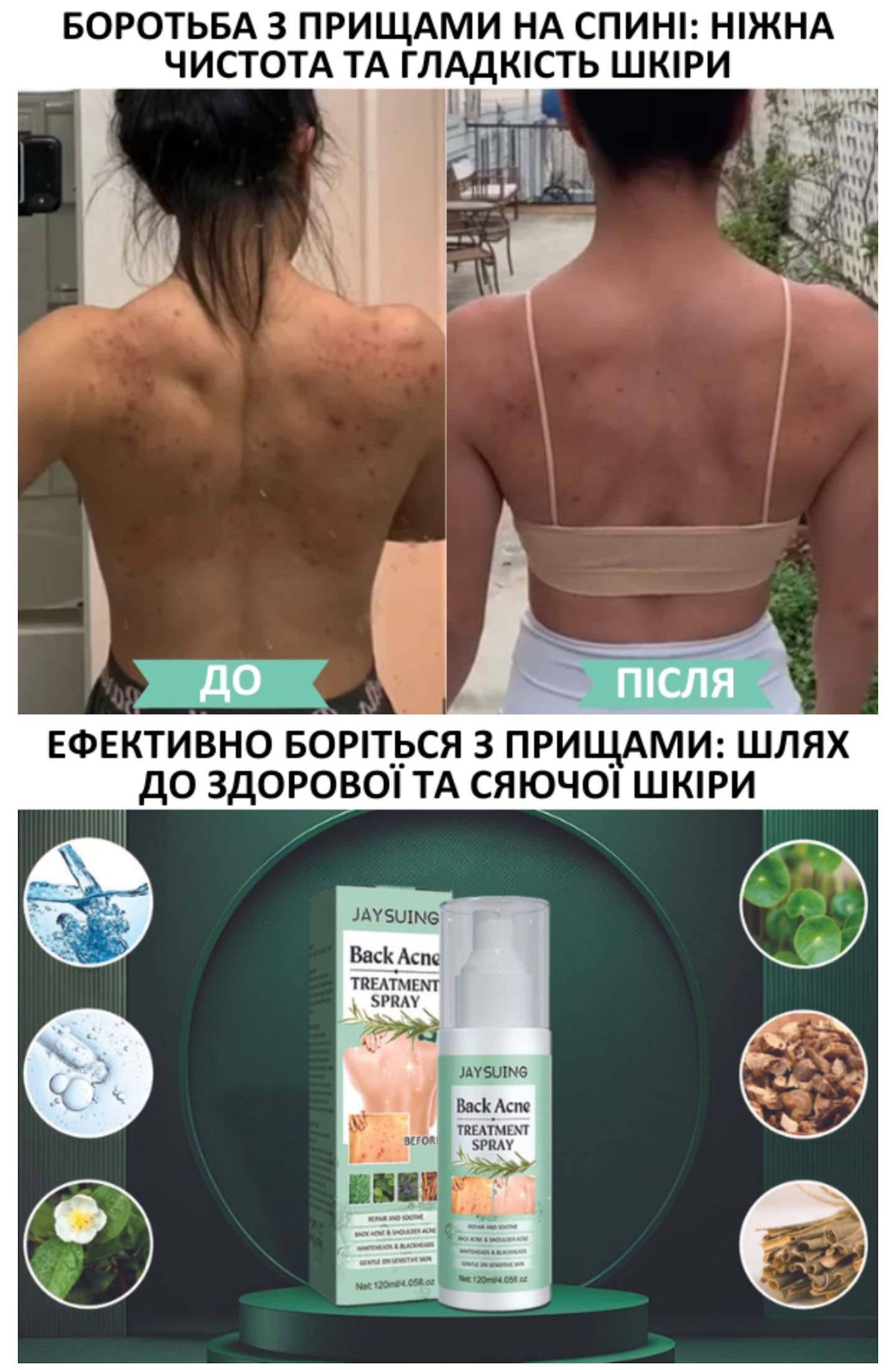 Стоимость Сайта Лендинга Спрей от Прыщей на Спине